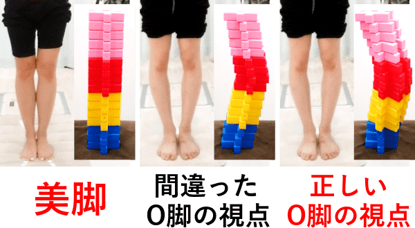 O脚の状態を解説