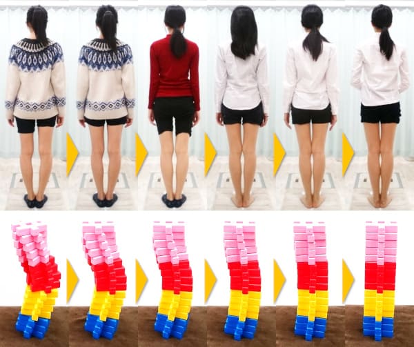 ねじれの解消により真っ直ぐな脚へ